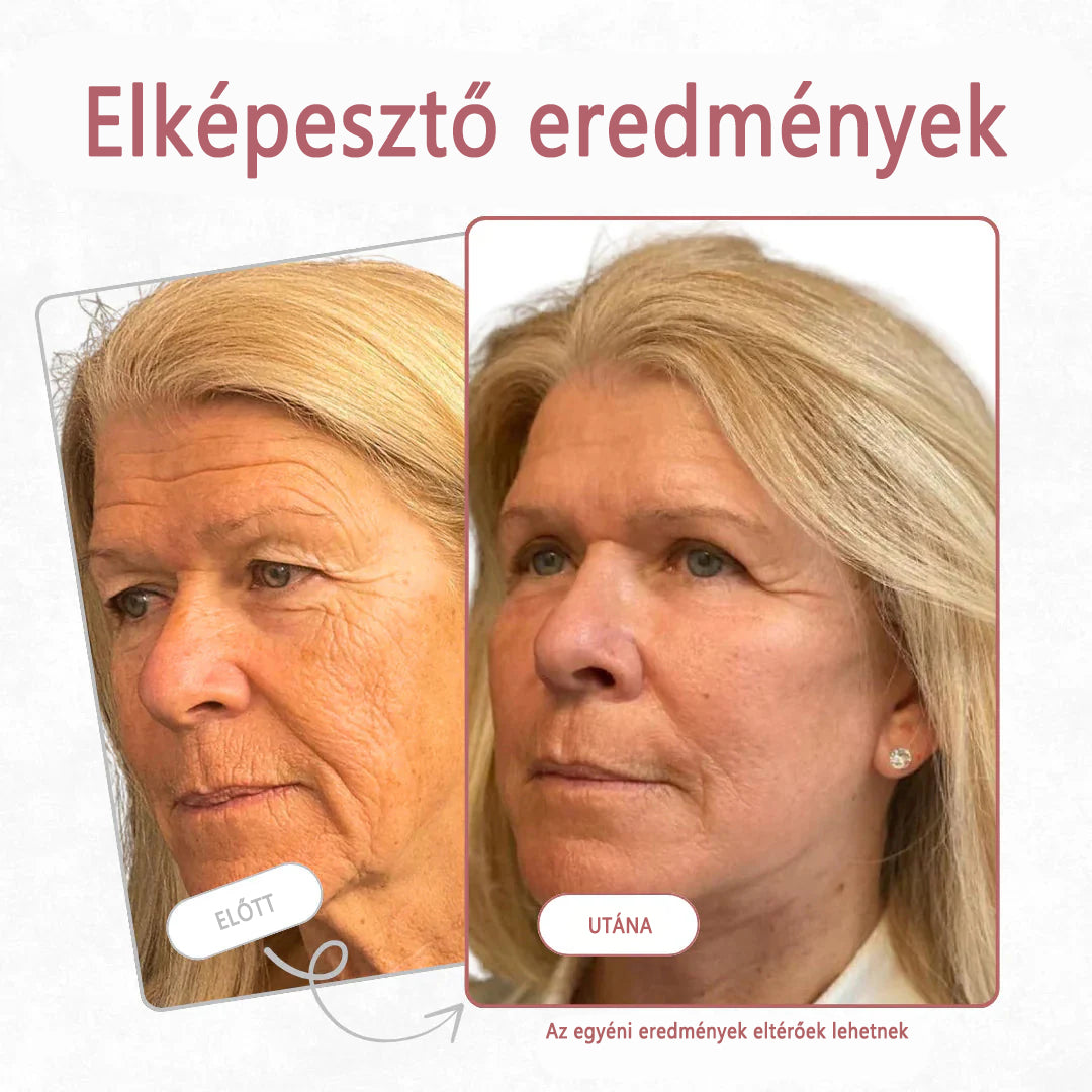 🔥  Első értékesítési termék Solaroza @ Calcium Polycollagen Improvement Cream - kalcium-ionokat, hexapeptid-8 és növényi kollagén kivonatokat tartalmaz, amelyek célzott hatást nyújtanak az egyes ráncokhoz - gyors javítás, 100% -os öregedésellenes hatás.