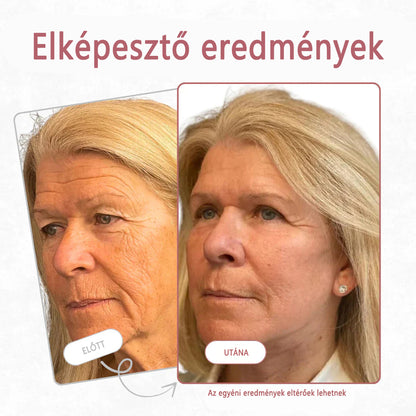 🔥  Első értékesítési termék Solaroza @ Calcium Polycollagen Improvement Cream - kalcium-ionokat, hexapeptid-8 és növényi kollagén kivonatokat tartalmaz, amelyek célzott hatást nyújtanak az egyes ráncokhoz - gyors javítás, 100% -os öregedésellenes hatás.