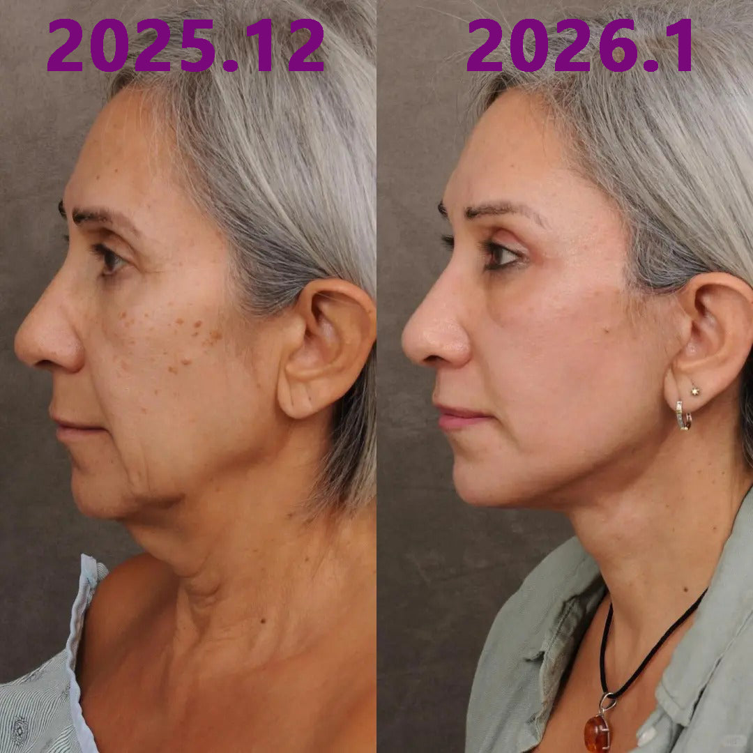 🔥  Első értékesítési termék Solaroza @ Calcium Polycollagen Improvement Cream - kalcium-ionokat, hexapeptid-8 és növényi kollagén kivonatokat tartalmaz, amelyek célzott hatást nyújtanak az egyes ráncokhoz - gyors javítás, 100% -os öregedésellenes hatás.