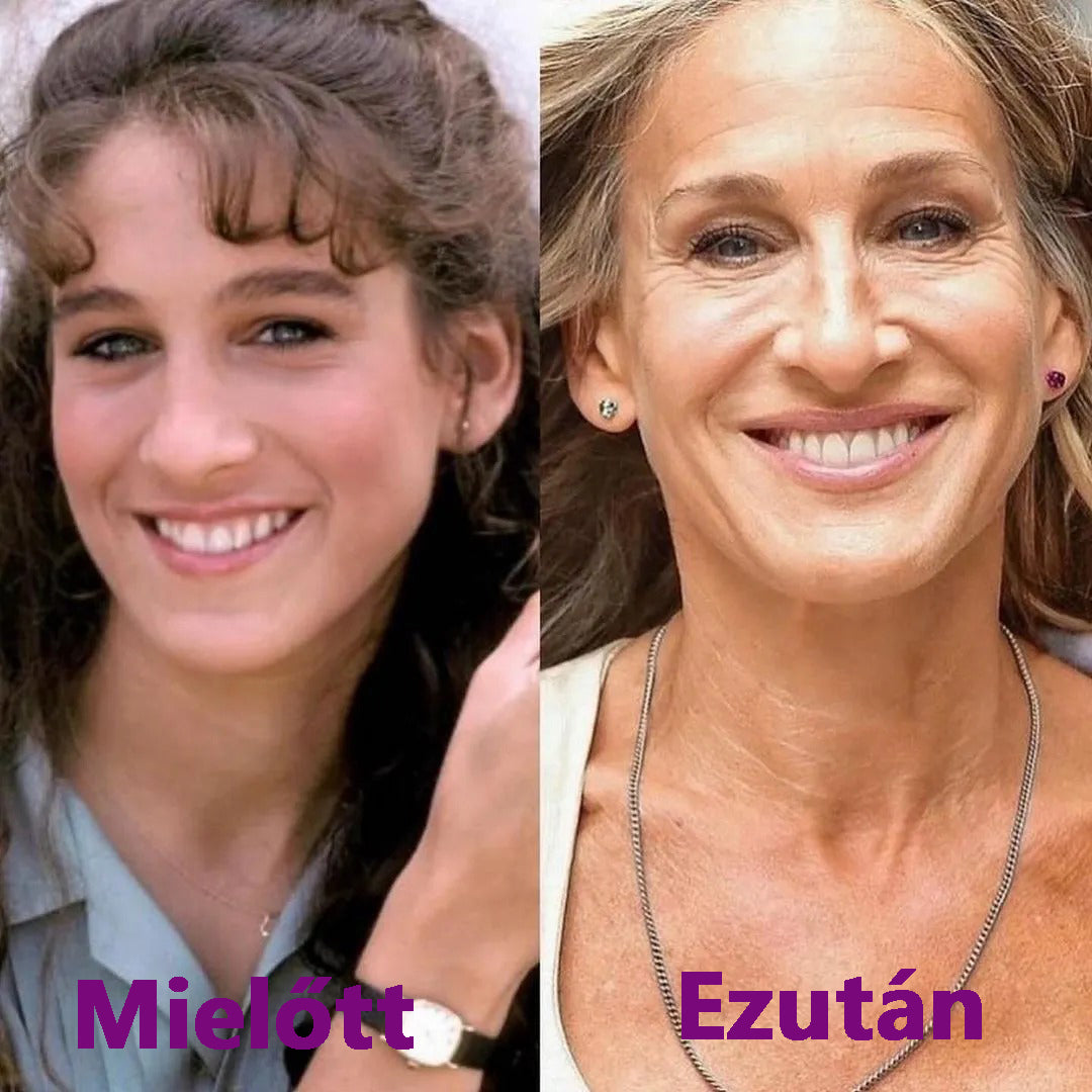 🔥  Első értékesítési termék Solaroza @ Calcium Polycollagen Improvement Cream - kalcium-ionokat, hexapeptid-8 és növényi kollagén kivonatokat tartalmaz, amelyek célzott hatást nyújtanak az egyes ráncokhoz - gyors javítás, 100% -os öregedésellenes hatás.