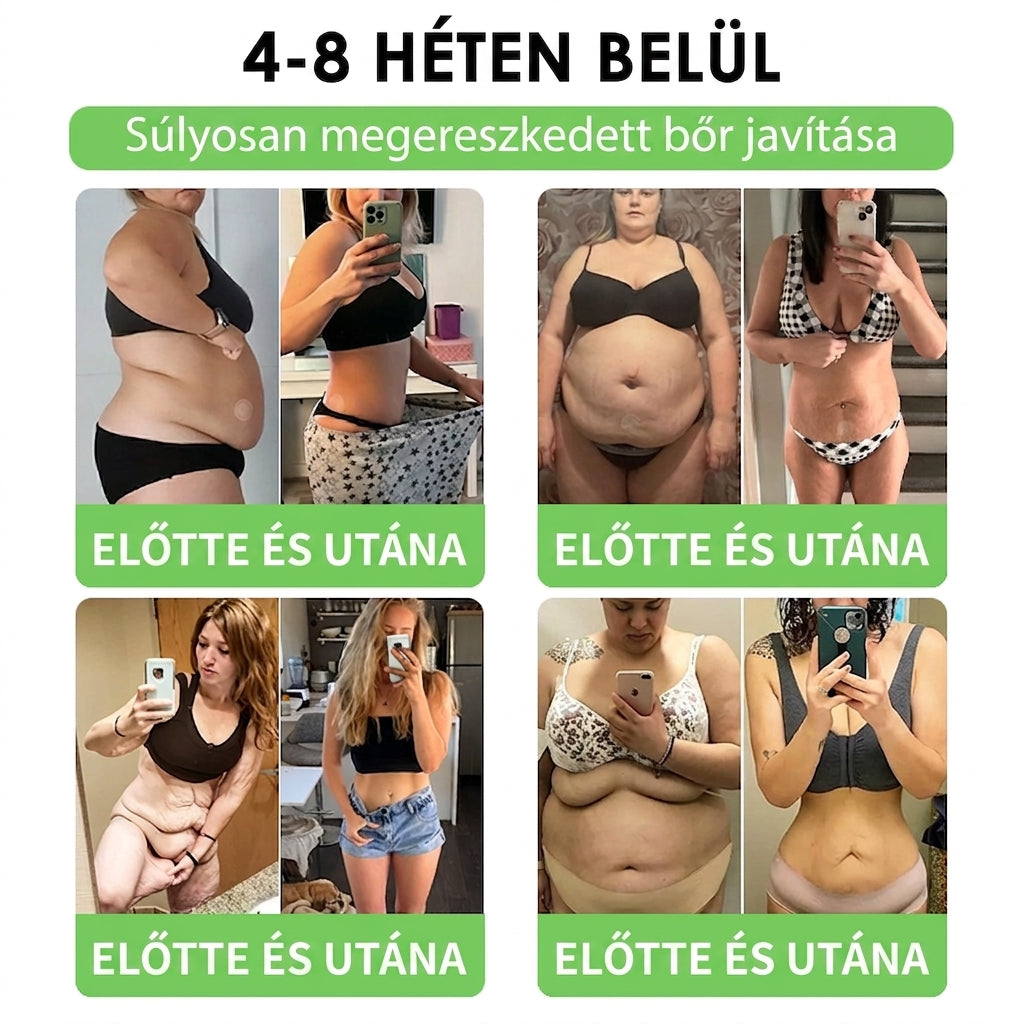 【💥2026 Új termékek és különleges ajánlatok: 80% kedvezmény】👑Solaroza® Moringa Berberine X NAD+ 10-10-1 fejlett nano mikrotűs tapasz - Naponta egyszer, látható eredmények 7 napon belül