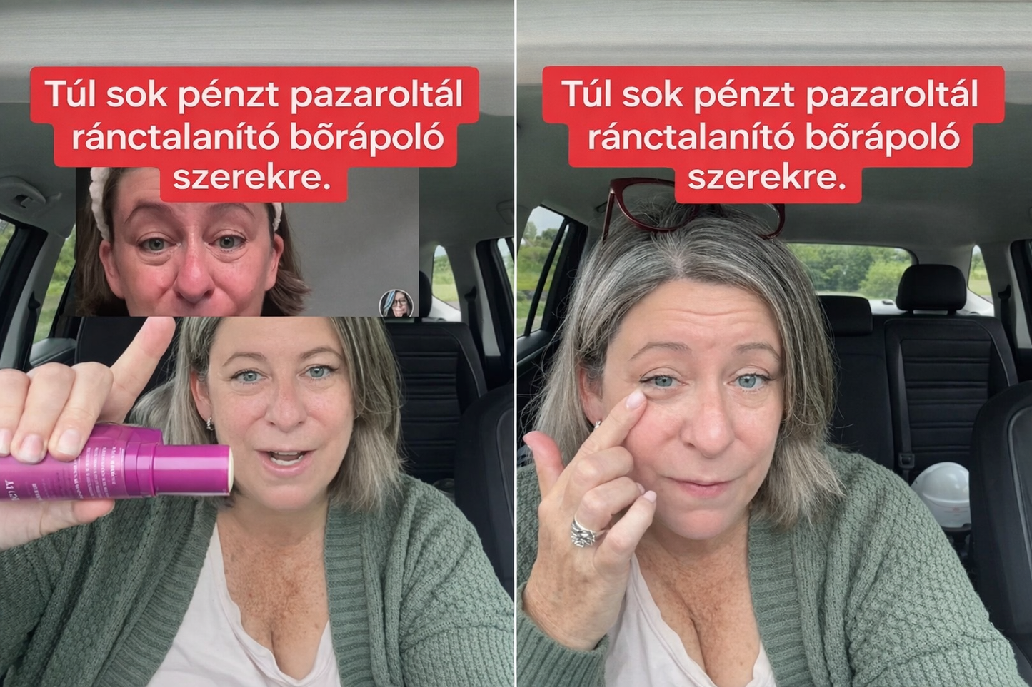 🔥  Első értékesítési termék Solaroza @ Calcium Polycollagen Improvement Cream - kalcium-ionokat, hexapeptid-8 és növényi kollagén kivonatokat tartalmaz, amelyek célzott hatást nyújtanak az egyes ráncokhoz - gyors javítás, 100% -os öregedésellenes hatás.